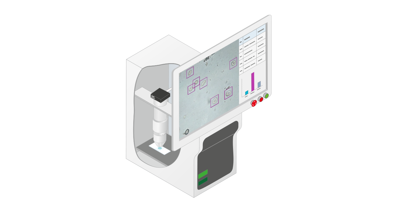 Basler基于CNN的尿液沉淀物自动显微镜检查视觉解决方案