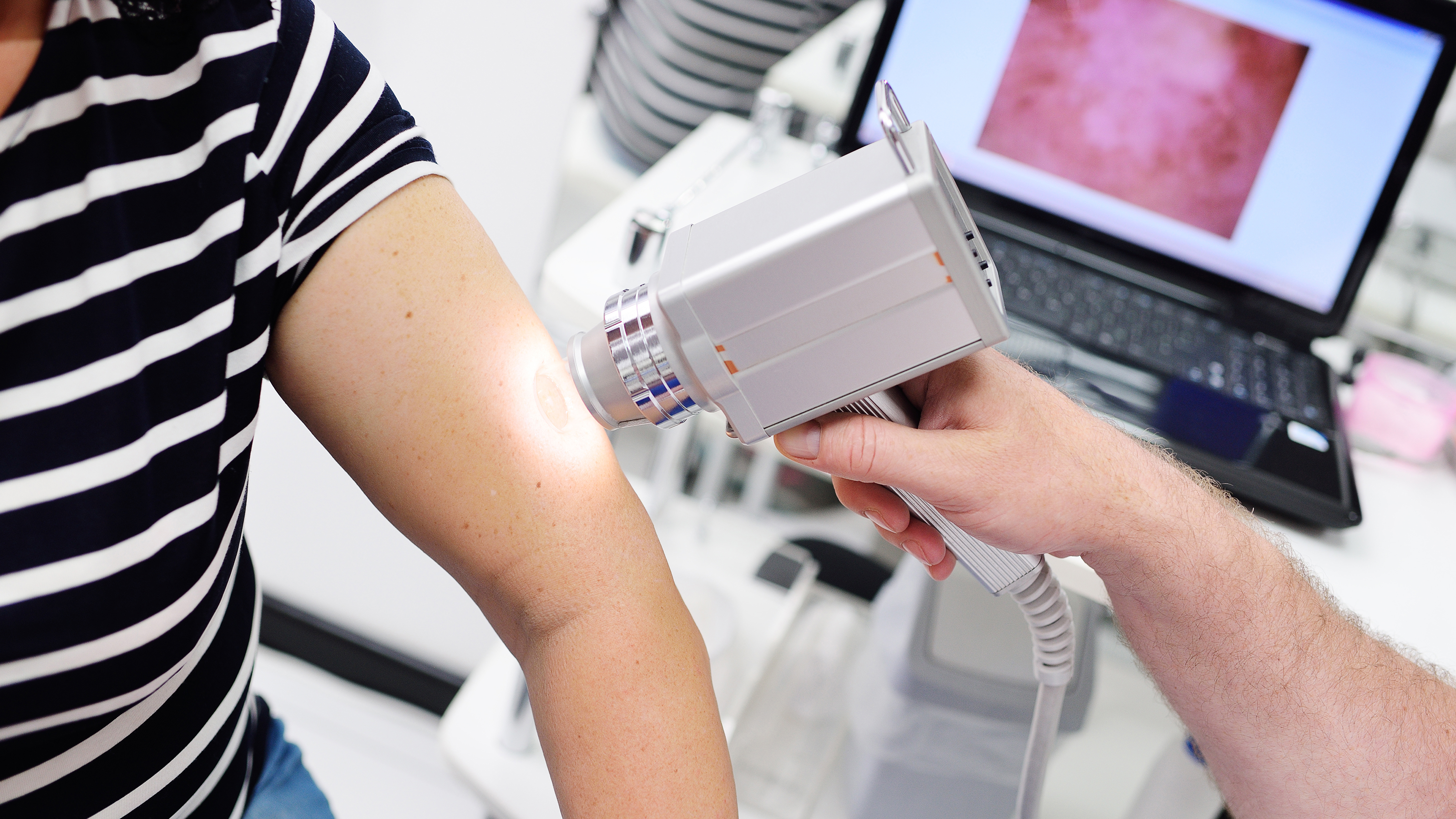 在不同的拍摄条件下，用于皮肤镜检查的相机依然可以游刃自如，并确保色彩保真度