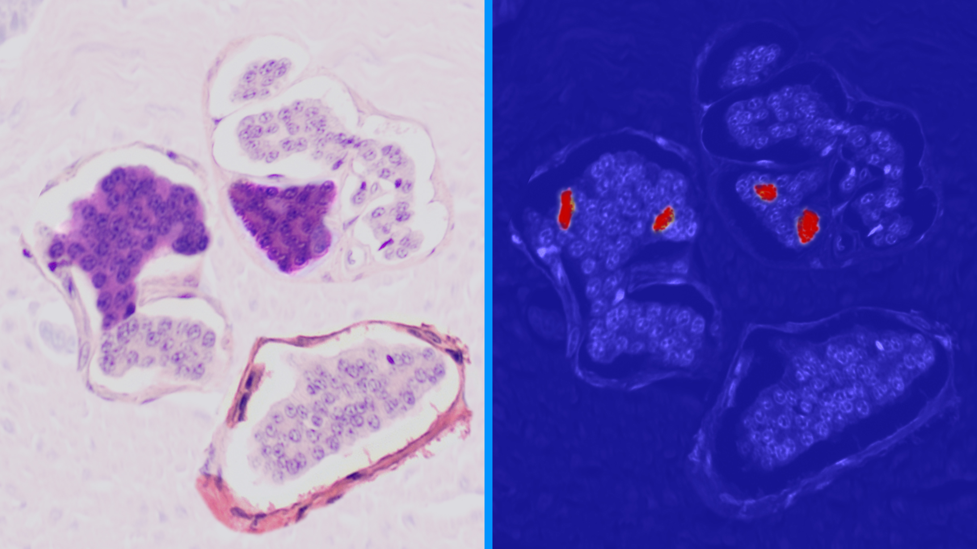 医疗领域的图像分析