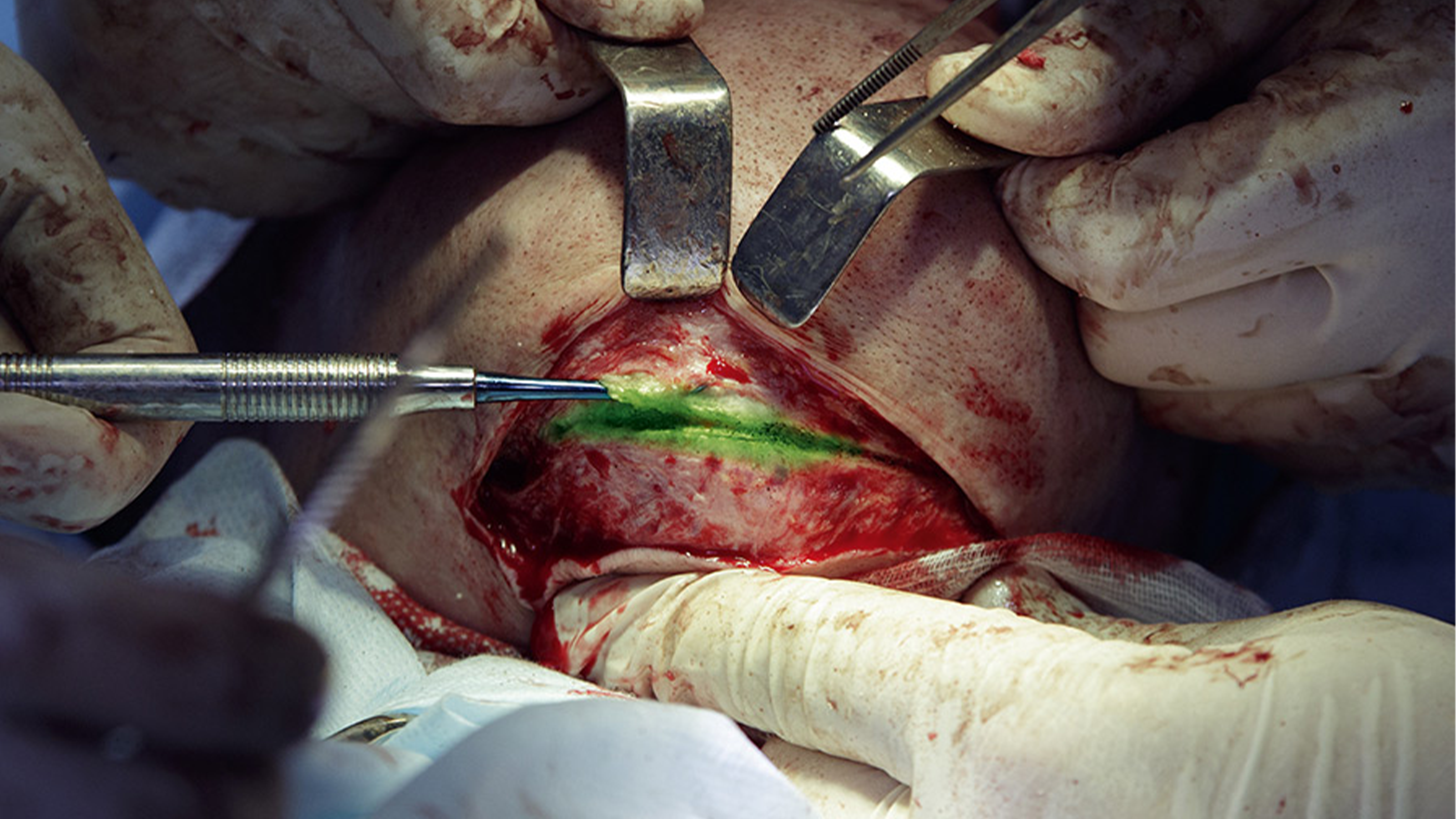 医疗领域的可视化